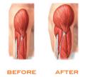 How Muscles Are Made