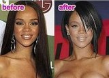 Rihanna had a nose surgery?