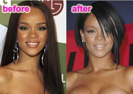 Rihanna had a nose surgery?