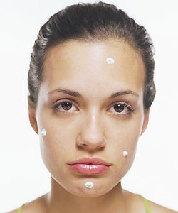 2007 Sugar Awards: Best Acne Fighter