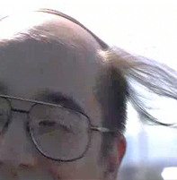 My Balding Boyfriend Needs A New "Do"