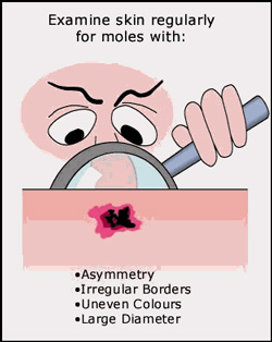 Photograph  Yourself -- Naked!!!  For Medical Reasons