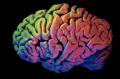 Brain Enhancement Anyone?