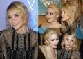 Olsen Teeth-apalooza! Hurray!